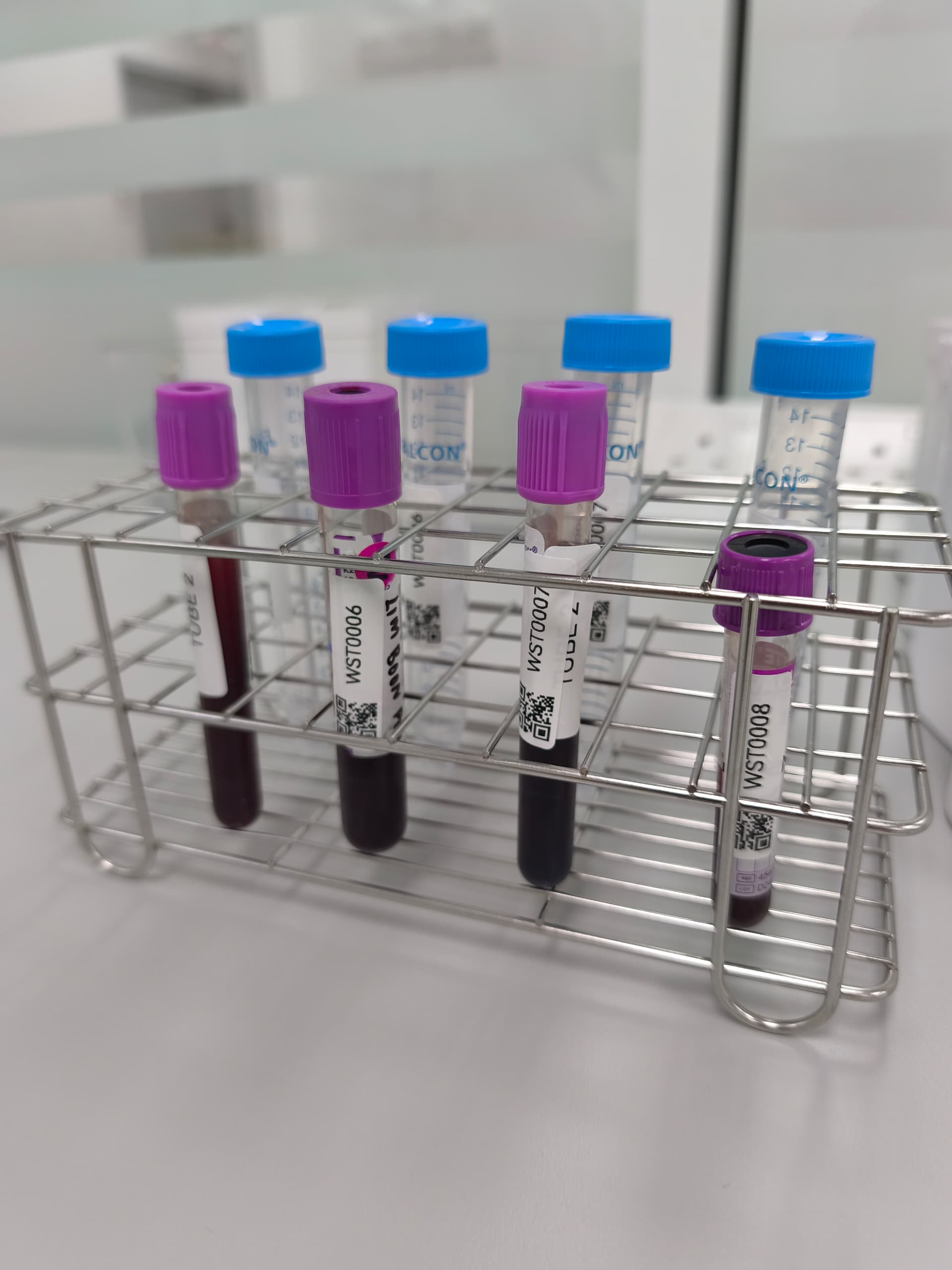 Blood sample with labeling and tagging